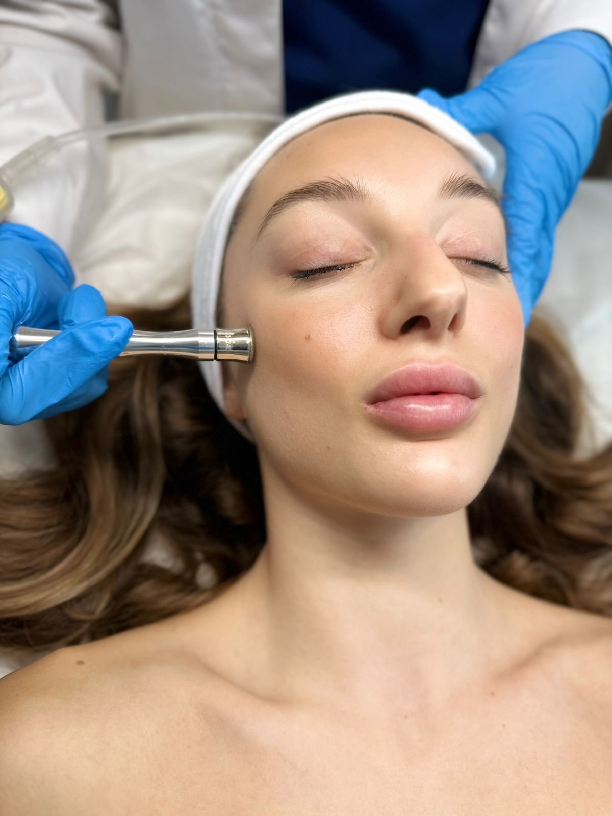 Δερμοαπόξεση με Διαμάντι